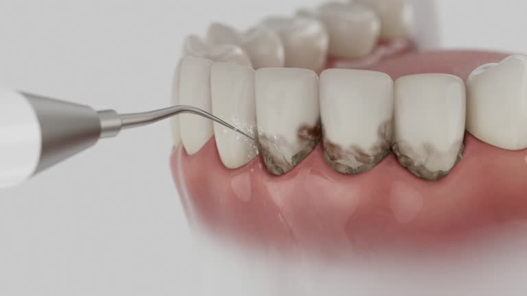 Trusted Tooth Extraction service in Brazoria, TX - Dentist Open Now